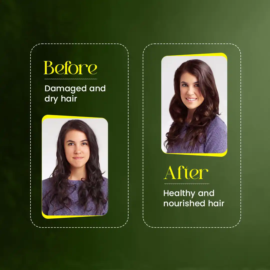 Deodar Hair Shampoo - Hair Growth & Scalp Health Naturally