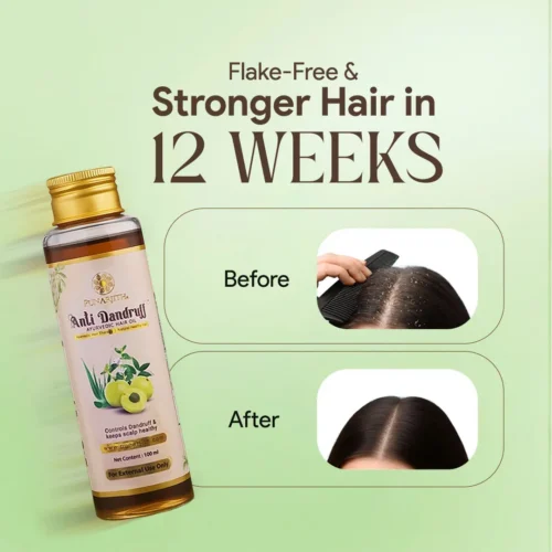 PUNARJITH ANTI-DANDRUFF OIL