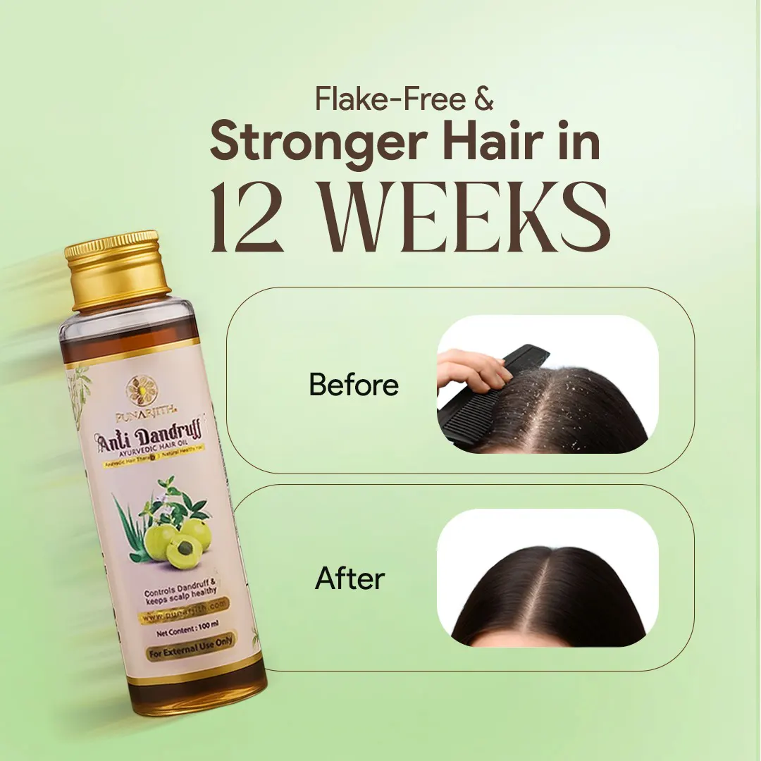 PUNARJITH ANTI-DANDRUFF OIL
