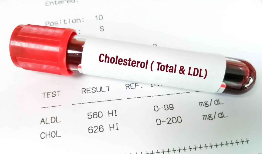 Cholesterol Warning Signs