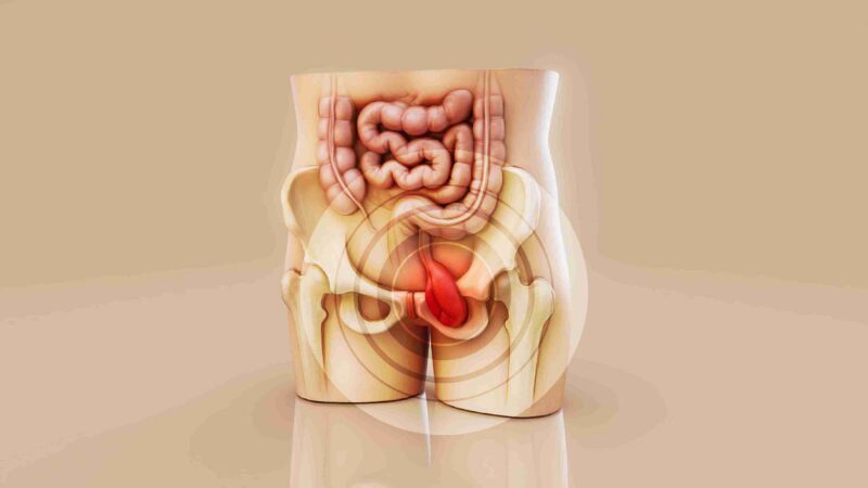 Piles symptoms and Ayurvedic care for hemorrhoids